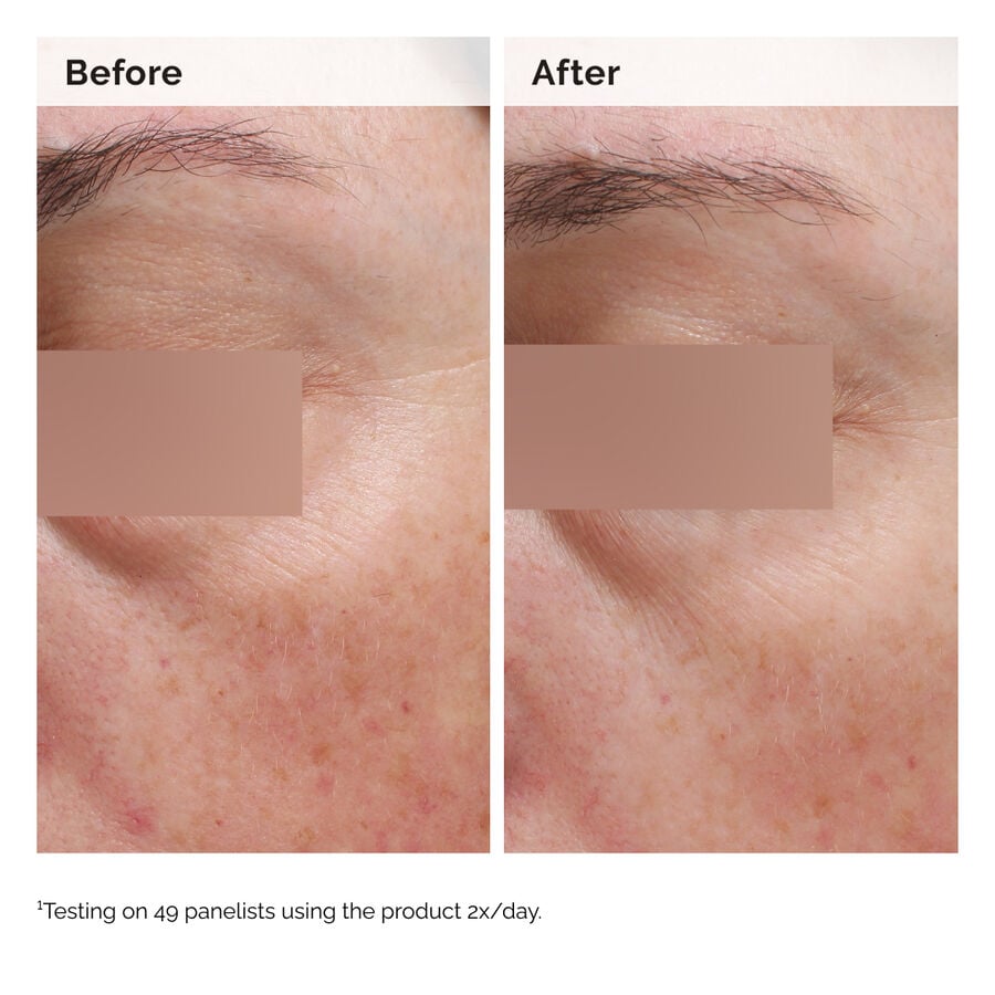 niacinamide-5-face-and-body-emulsion-y6 2024-08-23-ORD-Nia-5pct-Face-Body-B-A-Elasticity-Global-02-1x1.jpg