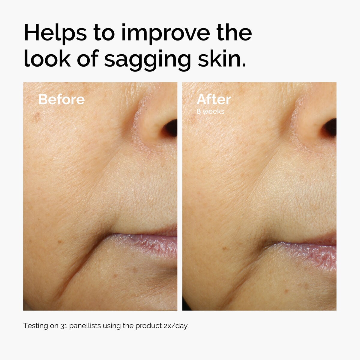 caffeine-3-escin-1-face-serum-u4 ord-caffeine-3pct-escin-1pct-face-serum-before-after-sagging.jpg