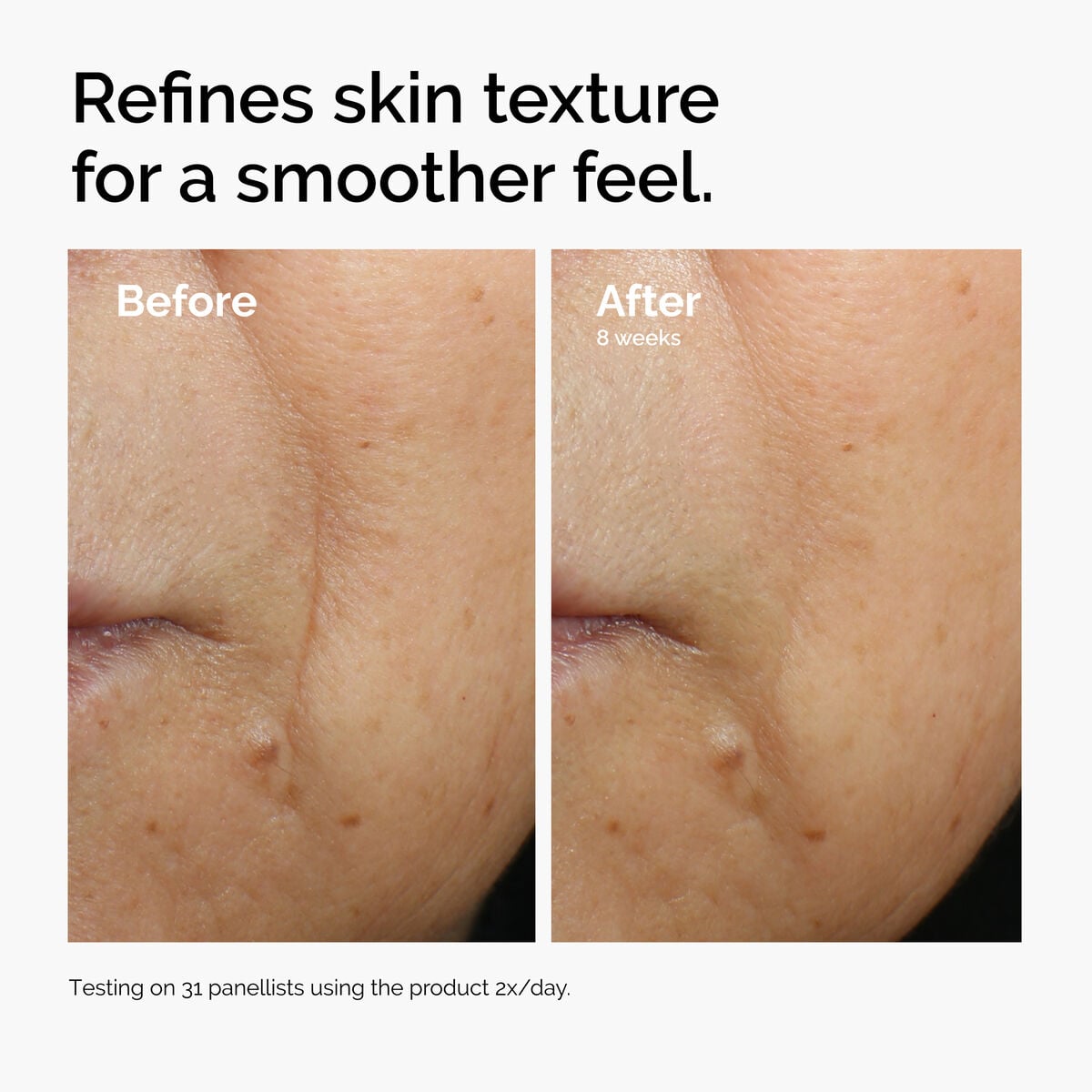 caffeine-3-escin-1-face-serum-u4 ord-caffeine-3pct-escin-1pct-face-serum-before-after-texture.jpg