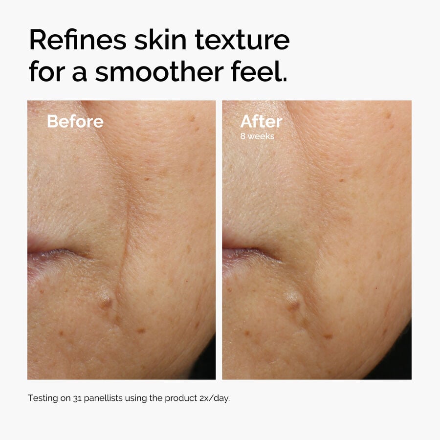 caffeine-3-escin-1-face-serum-u4 ord-caffeine-3pct-escin-1pct-face-serum-before-after-texture.jpg
