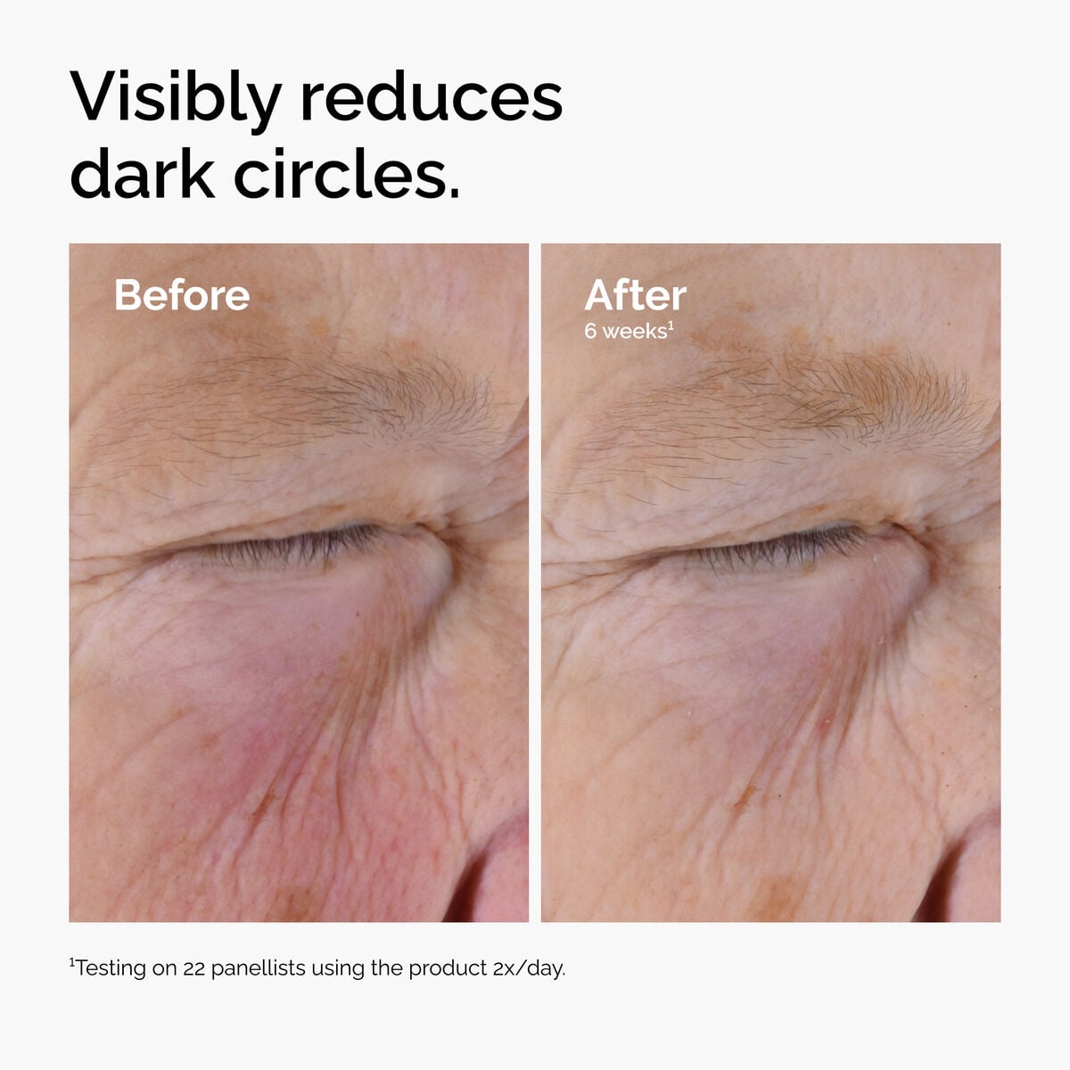 caffeine-solution-5-egcg-eye-serum-v4 ord-caffeine-solution-egcg-dark-circles-before-after.jpg