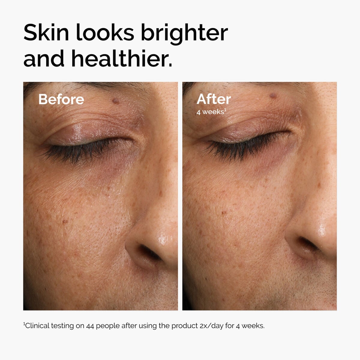 multi-antioxidant-radiance-serum-a2 ord-mars-before-after-healthy.jpg