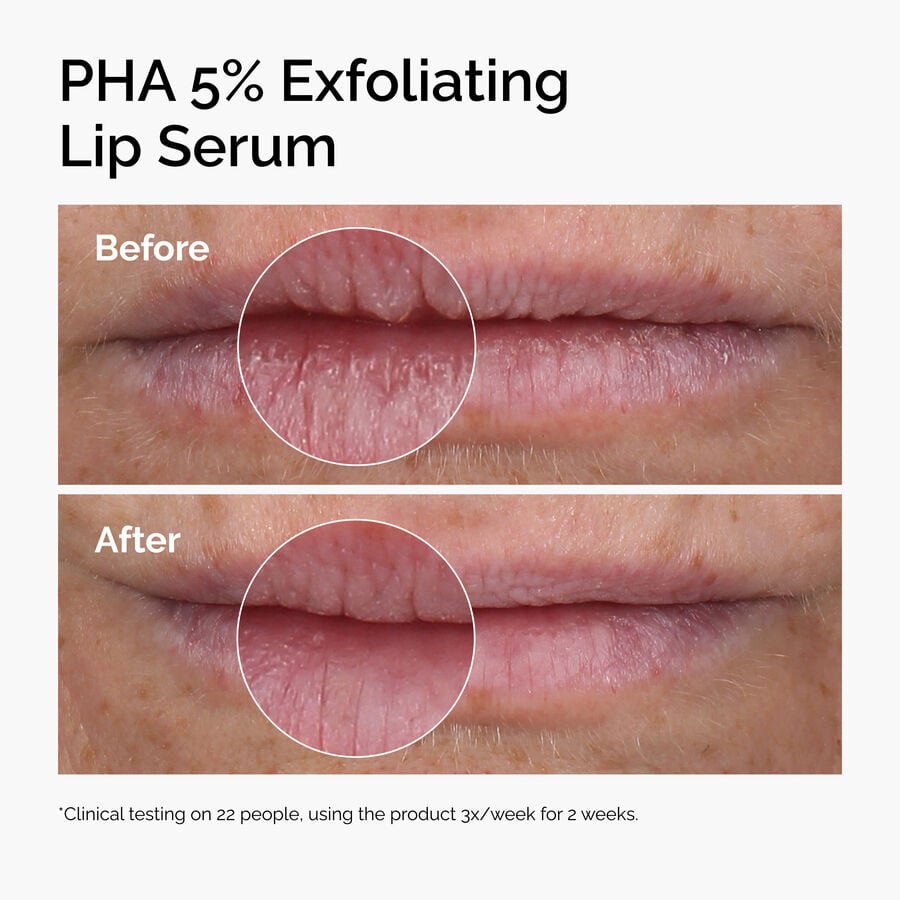 pha-5-exfoliating-lip-serum-a2 ord-pha-5pct-lip-exfoliating-serum-before-after.jpg