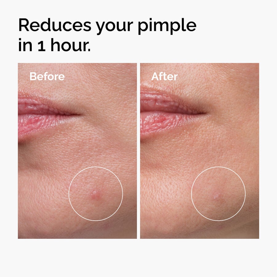 sulfur-10-powder-to-cream-concentrate-f0 ord-sulfur-10pct-powder-to-cream-concentrate-before-after-NA.jpg